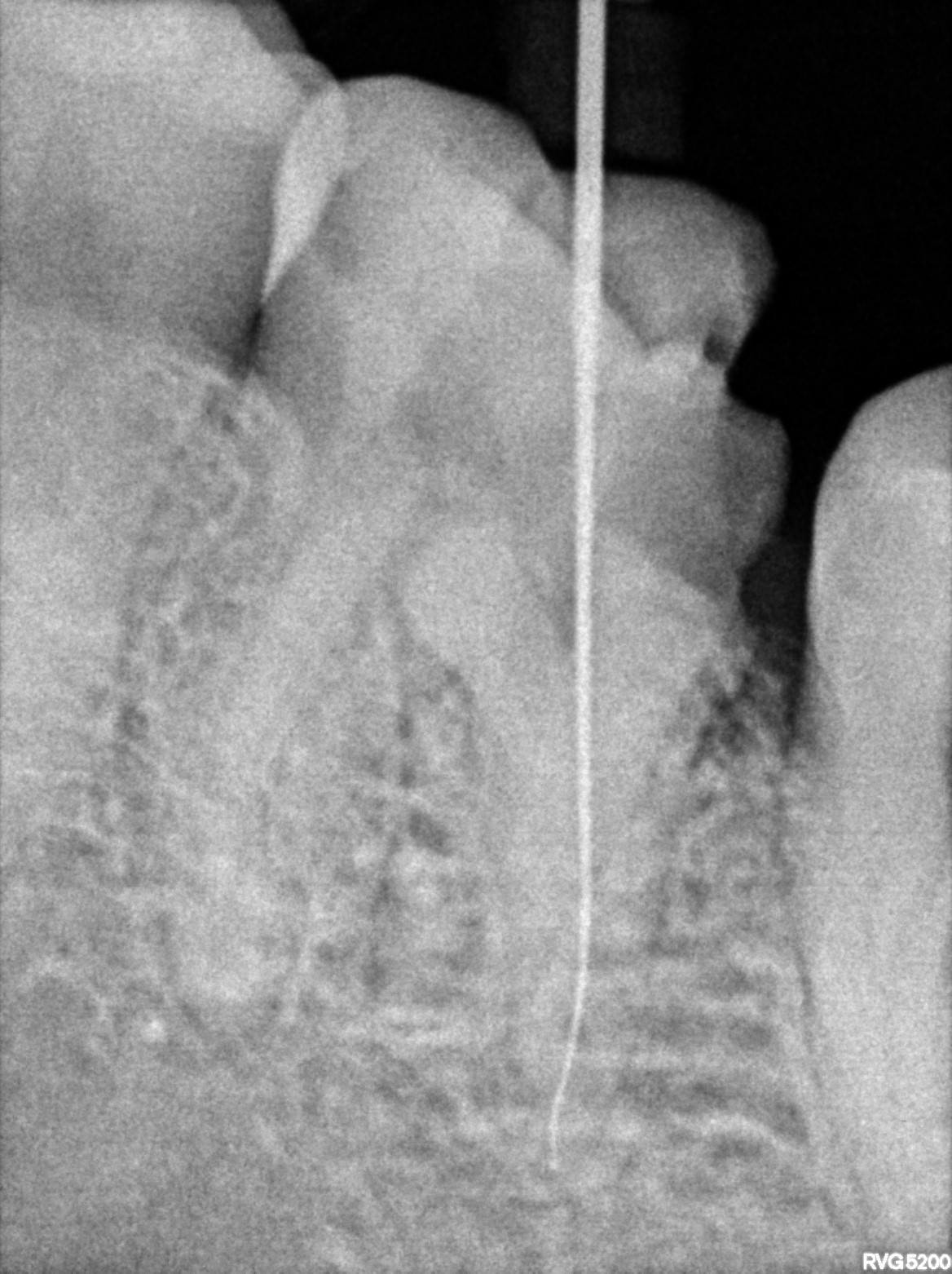 Dental X-ray